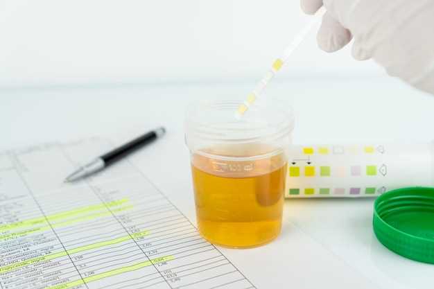 Причины получения отрицательных результатов в анализе мочи