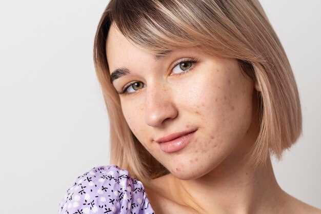 Механизмы реакции кожи на стресс