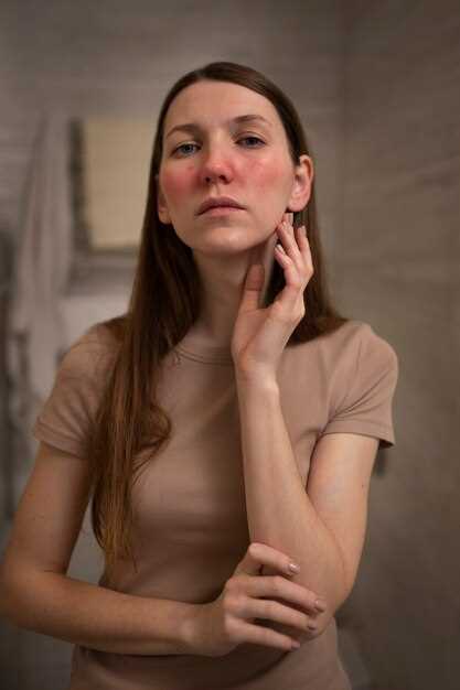 Профилактика появления лопнувших сосудов на лице