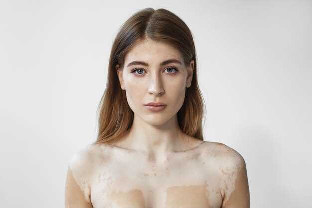 Симптомы и признаки рака кожи на лице у женщин