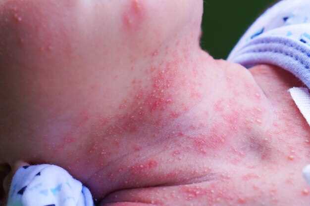 На какие сроки стоит обратить внимание в зависимости от возраста ребенка?