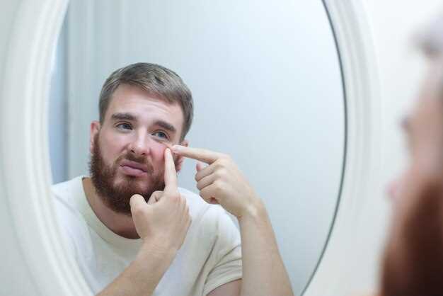 Причины появления прыщей на лбу у мужчин