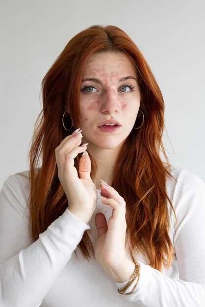 Прыщи на лице и связь с состоянием внутренних органов