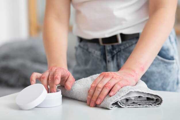 Рекомендации по уходу за пораженной кожей в домашних условиях