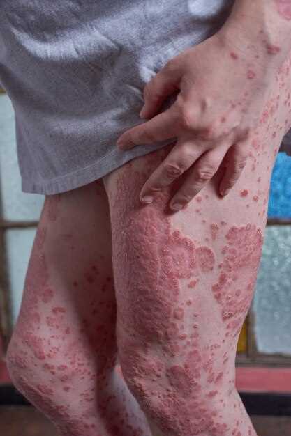 Дети старше 2 лет